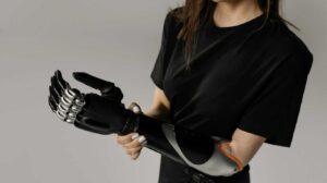 How Do Prosthetic Arms Work