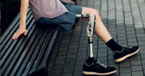 Types of Prosthetic Limbs